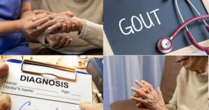 Bệnh Gout có di truyền không?