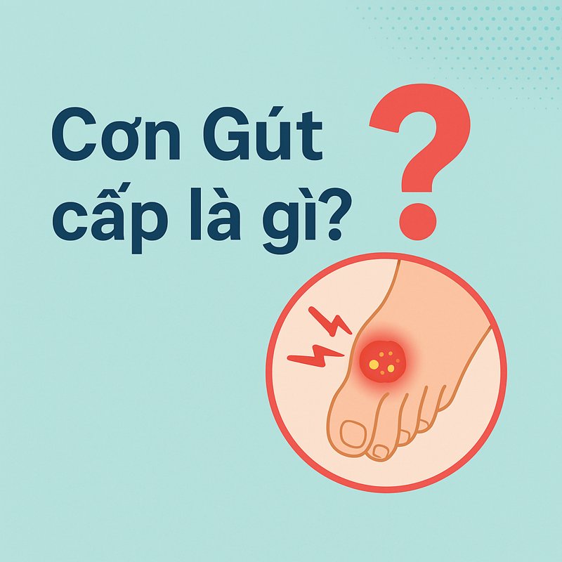 Cơn Gút cấp là gì? Hình minh họa đau khớp ngón chân do acid uric cao